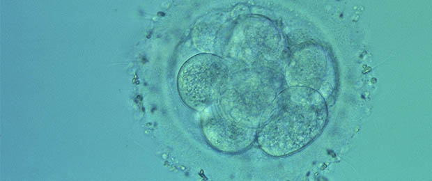 04bis_embryonhu72h